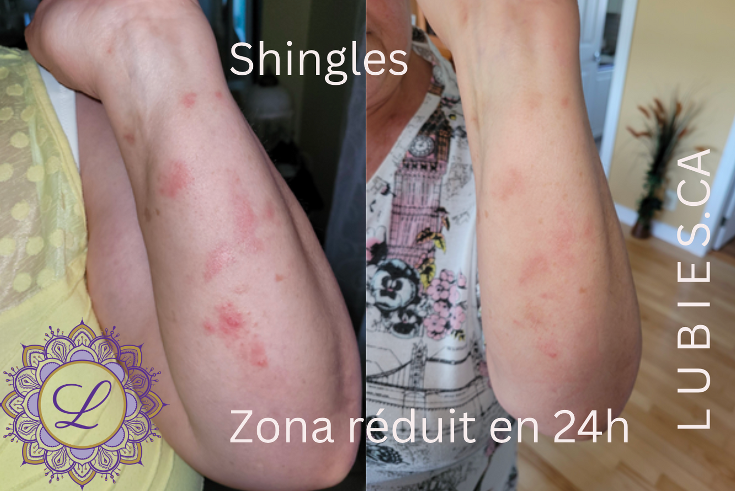 Onguent Noir Goudron de Pin Black Salve Ointment